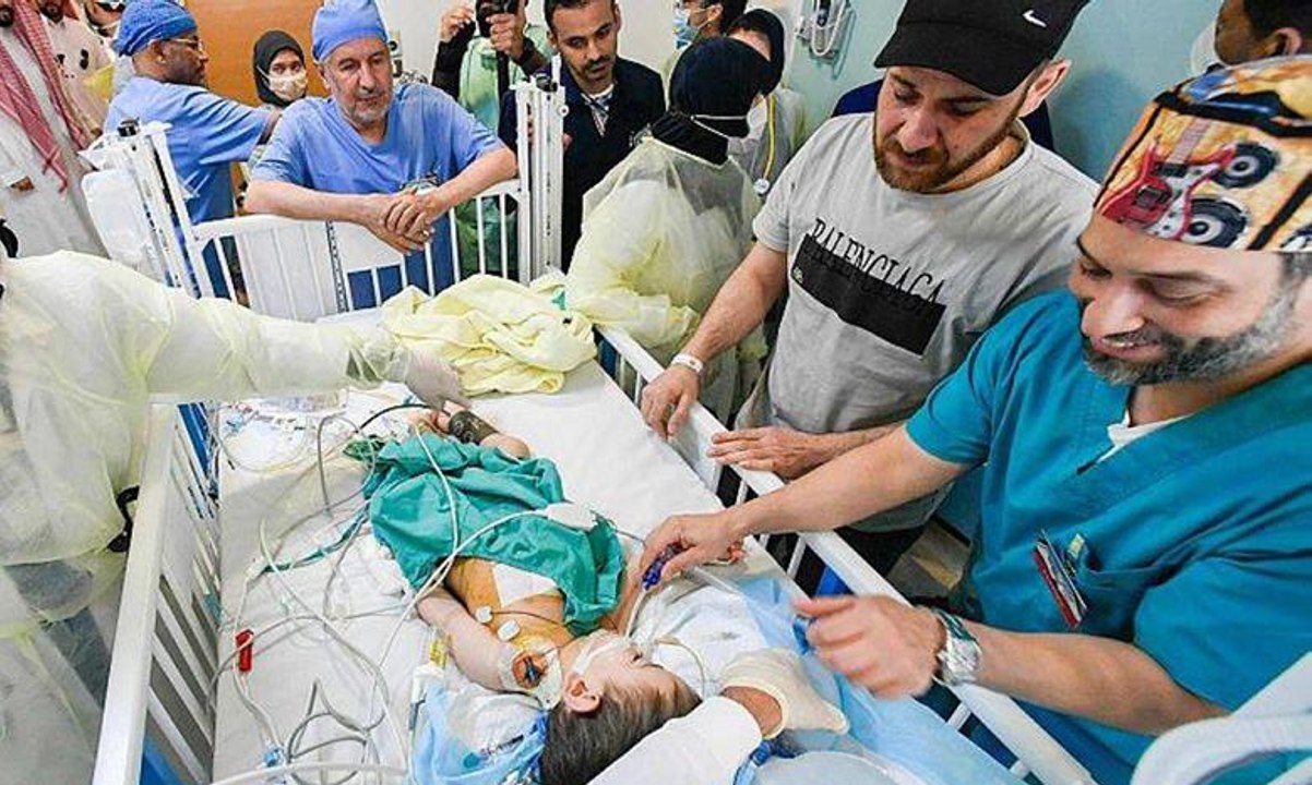 نجاح فصل التوأم السيامي السوري إحسان وبسام بالسعودية