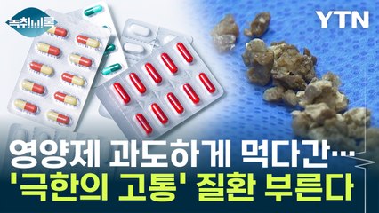 영양제 과도하게 먹다간...'극한의 고통' 이 질환 부른다 [Y녹취록] / YTN