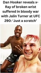 Dan Hooker reveals x-ray of broken wrist suffered in violent fight with Jalin Turner at UFC 290.