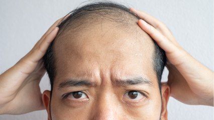 Des chercheurs auraient trouvé la solution pour combattre la calvitie !