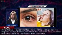 Be well: Treat and prevent pink eye with a health specialist's top tips - 1breakingnews.com