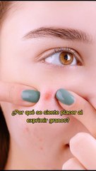 ¿Por qué se siente placer al exprimir granos?