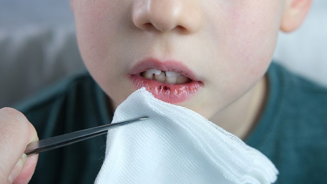 bd-afectaciones-en-los-dientes-de-los-niños-100723