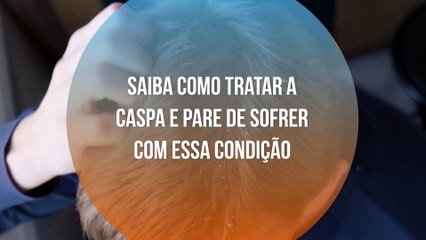 Dicas eficazes para acabar com a caspa e cuidar do couro cabeludo 🧴