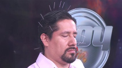 Elimina el dolor de cabeza y otros malestares con este tratamiento con agujas