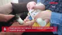 Doğduğundan beri ağlayan Adem bebeğin vücudunda enjektör iğnesi çıktı