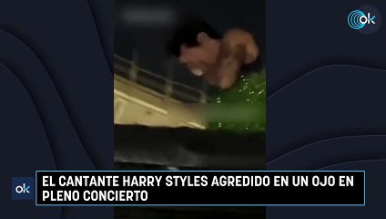 El cantante Harry Styles agredido en un ojo en pleno concierto