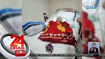 Bata, nahulog sa lutuan ng uling; kinailangang putulan ng kanang binti | 24 Oras