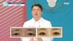 [BEAUTY]Middle-aged and old-aged eyes! What's the effect of the upper eyelid surgery?,기분 좋은 날 230713
