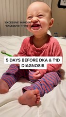 Today’s “FUN FACTS” are about T1D Signs/Symptoms .