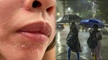 मॉनसून में ड्राई स्किन होने का कारण | Monsoon Me Dry Skin Hone Ka Karan | Boldsky