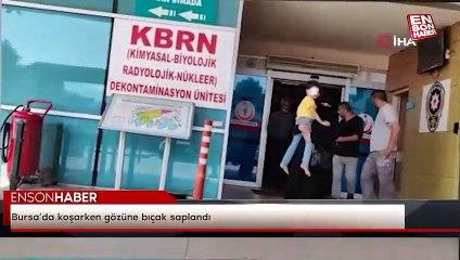 Bursa’da koşarken gözüne bıçak saplandı