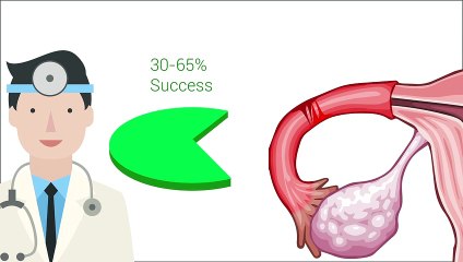 Common Causes of Female Infertility