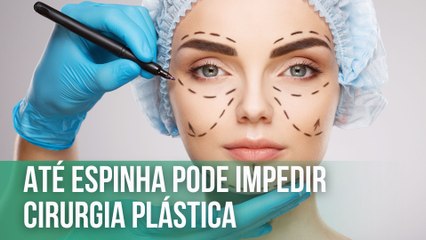 Fala, Doutor - Cirurgia plástica