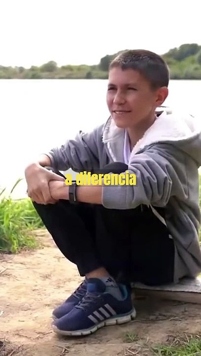 Hombre de 35 dejó de crecer a los 13 años y parece adolescente