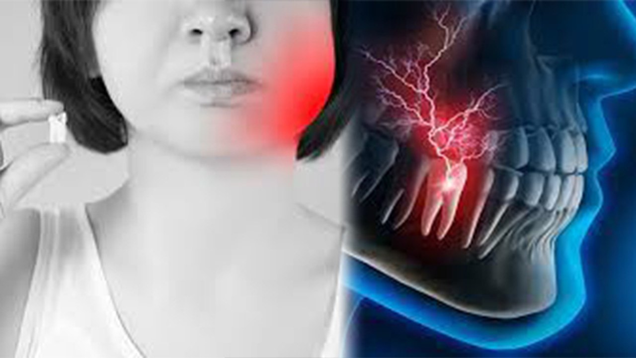 Root Canal Ke Bad Dant Me Dard Kyu Hota Hai | रूट कैनाल के बाद दांत दर्द क्यों होता है | Boldsky