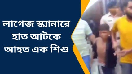 পূর্ব বর্ধমান: লাগেজ স্ক্যানারে আটকে গেল হাত! আহত শিশু