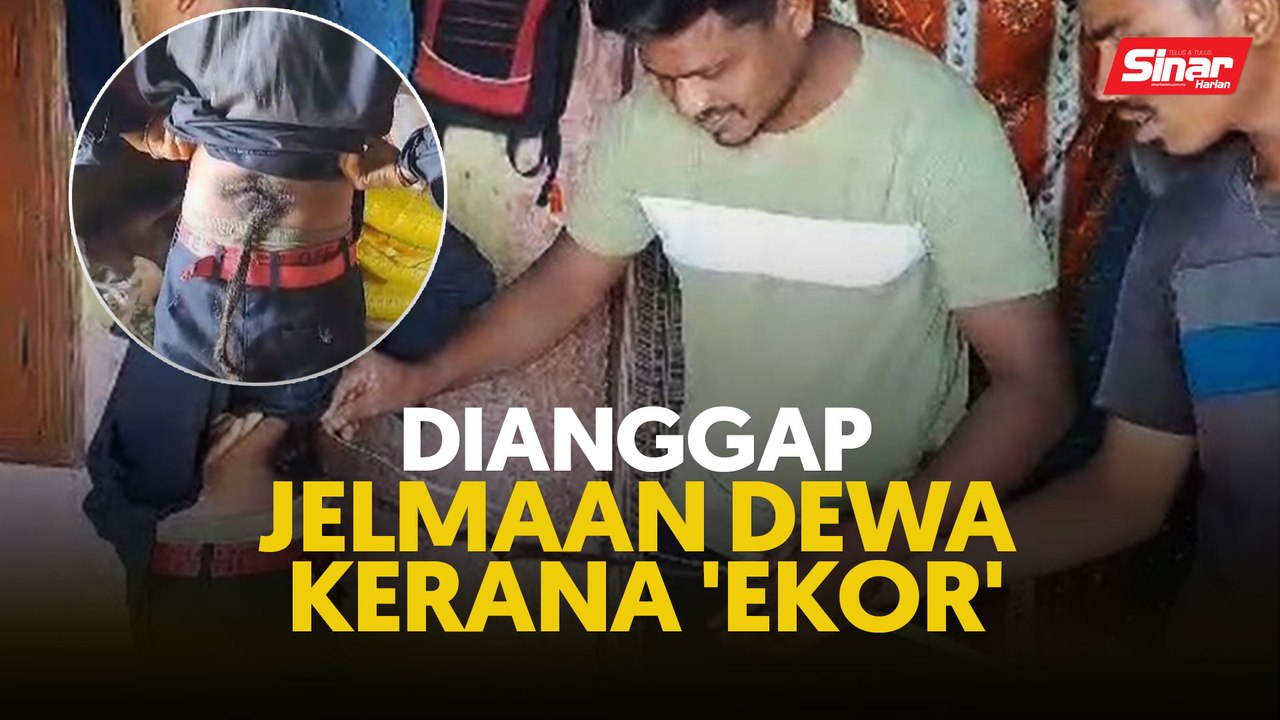 Dianggap jelmaan dewa kerana 'ekor'