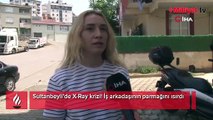 Sultanbeyli’de X-Ray krizi! İş arkadaşının parmağını ısırdı