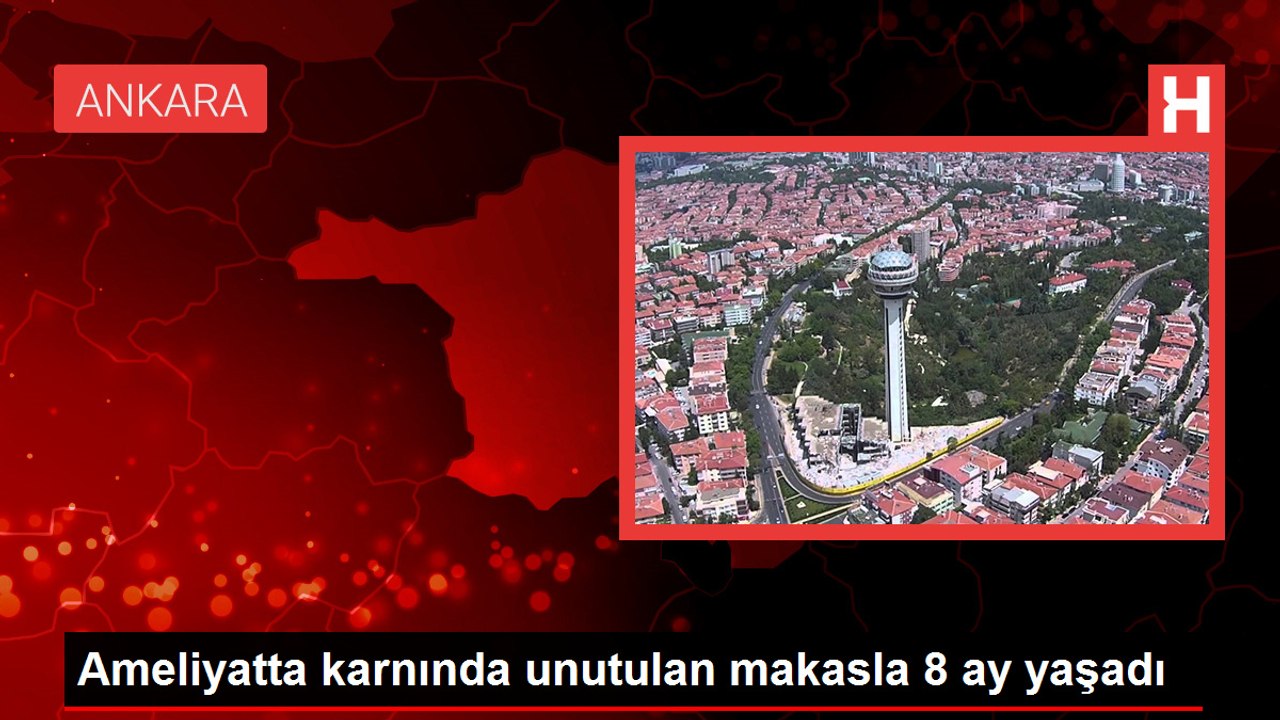 Ameliyatta unutulan makasla 8 ay yaşadı