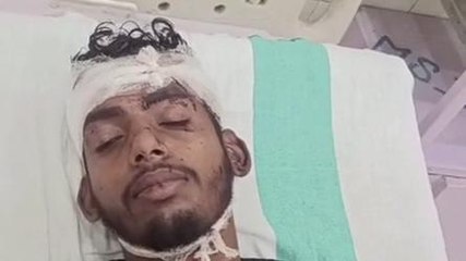 रायबरेली: शराब के नशे में नशेड़ी ने मचाया जमकर उत्पात, दो लोग घायल