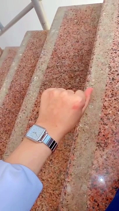 حيرة و3 مستشفيات عاجزة.. "غيد" فتاة تفقد التحكم بأصابع يدها ووالدها يناشد