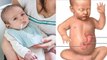 बच्चा दूध पीने के बाद उल्टी क्यों करता है | Baccha Dudh Pine Ke Bad Ulti Kyon Karta Hai | Boldsky