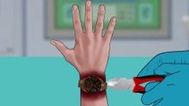 [ASMR Animation] Are You Wearing Your Watch Too Tight Be careful when wearing the watch too tight - Treatment hand - Deep Cleaning