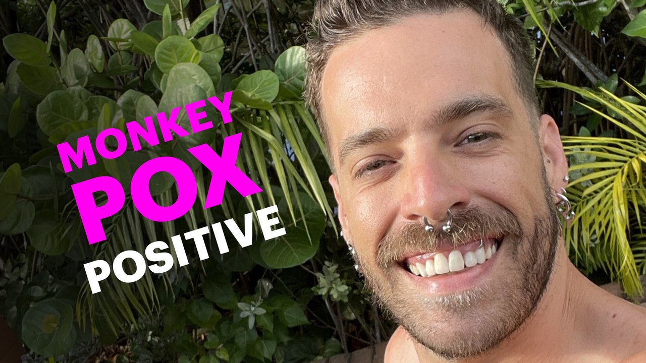 What to Do if You Get Monkeypox