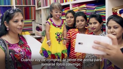 ⁰⁶ LA MUJER MÁS BAJA DEL MUNDO (28 años, 62 cm (24 pulgadas) (Ruhi Cenet)