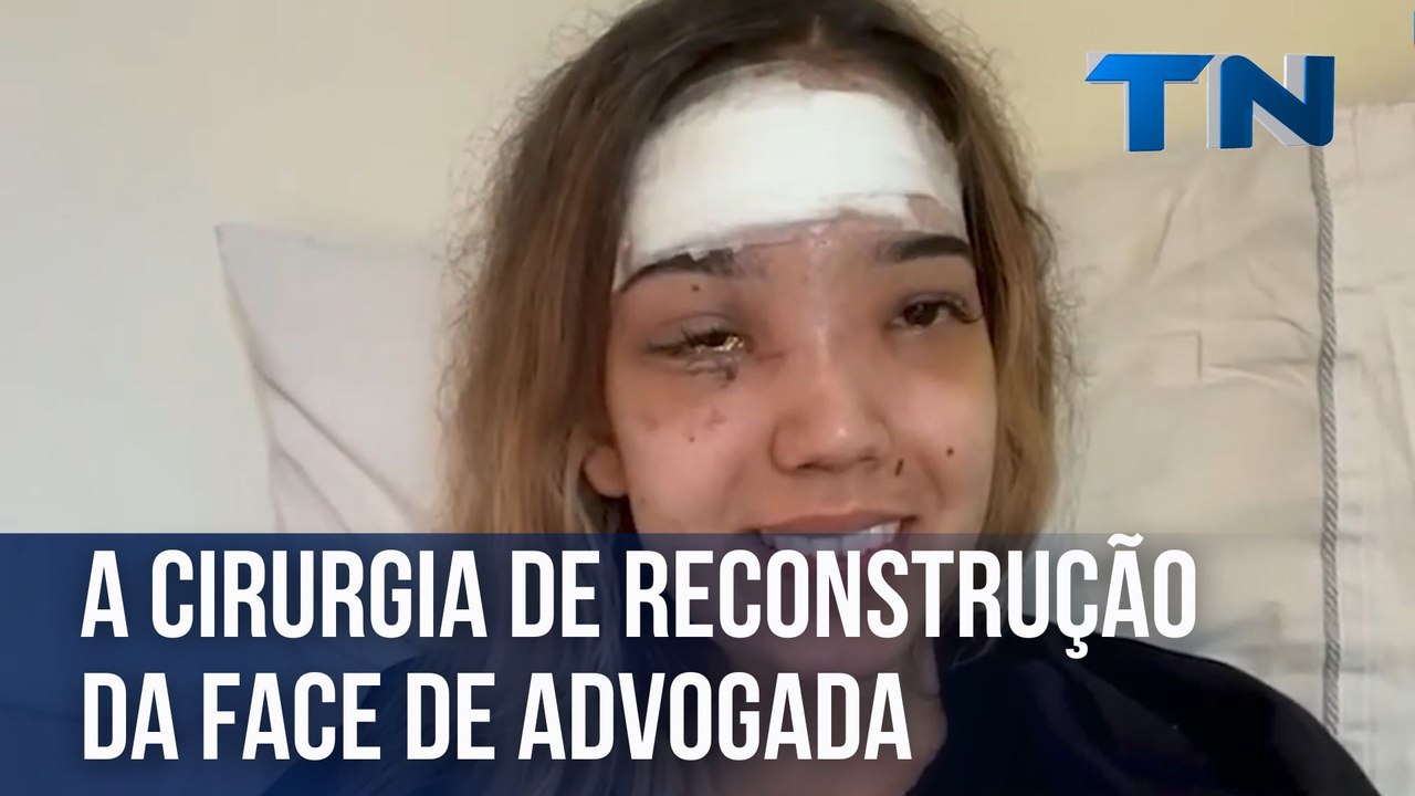 A cirurgia de reconstrução da face de advogada