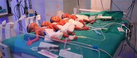अनूठा मामला--जिला चिकित्सालय में महिला ने एक साथ चार बच्चों को दिया जन्म