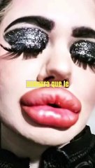 la mujer con los labios más gruesos del mundo (3)