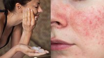 चेहरे पर फिटकरी लगाने के नुकसान | Chehre Par Fitkari Lagane Ke Nuksan | Boldsky