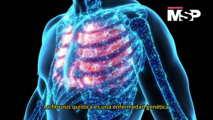¿Cómo actúa la fibrosis quística? - #ExclusivoMSP
