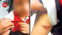 Preocupación en Cuautitlán Izcalli: Abuelo del niño de kínder muestra fotos de presuntas lesiones