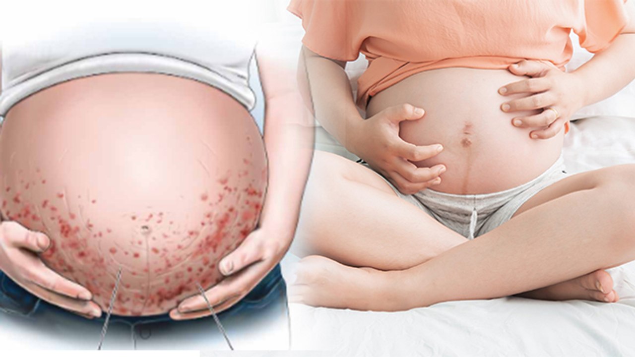 Pregnancy Me Nabhi Me Khujli Kyu Hoti Hai | प्रेगनेंसी में नाभि में खुजली क्यों होती है | Boldsky