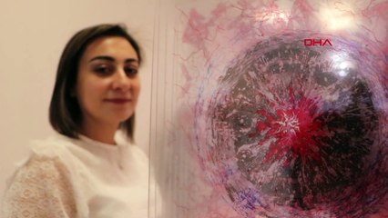 Migren Hastalığı Sanata Yansıtıldı