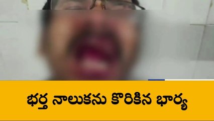 ముద్దు పెట్టేందుకు వచ్చిన భర్త... నాలుక కొరికేసిన భార్య