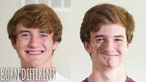 We're Identical Twins - But Only On One Side | BORN DIFFERENT