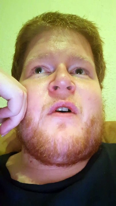 Zwei Tage LSD schaffen dich #drachenlord #rainerwinkler #drachengame #Drogen #viral #lukasheil