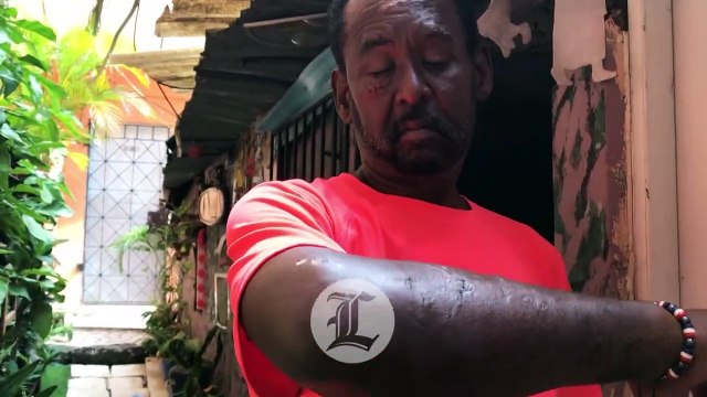 “Dios me protegió dice enfermo de cáncer tras ser atacado de perro pitbull cerca de su casa