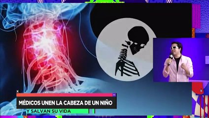 Médicos unen la cabeza de un niño