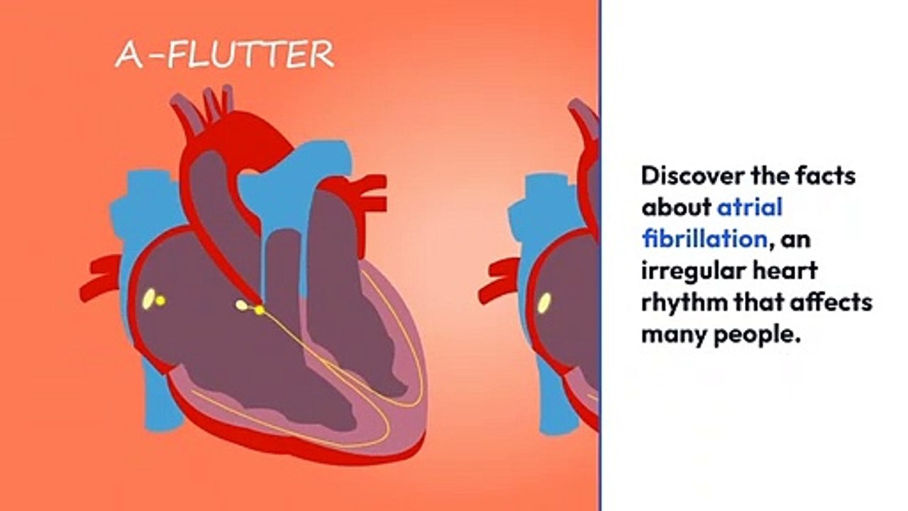What is a cardiac arrest Secrets