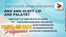 Say ni Dok | Cleft palate Awareness Month