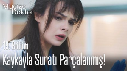 Kaykayla suratı parçalanmış! - Mucize Doktor 19. Bölüm