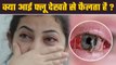 Conjuctivitis Kaise Failta Hai: Eye Flu Dekhne Se Failta Hai | Eye Flu Failta Hai Kya | Boldsky