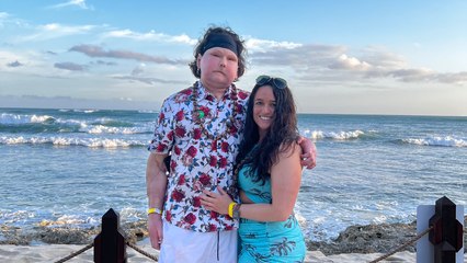 “I Had World’s First Face and Double Hand Transplant - My Donor Was Twice My Age”