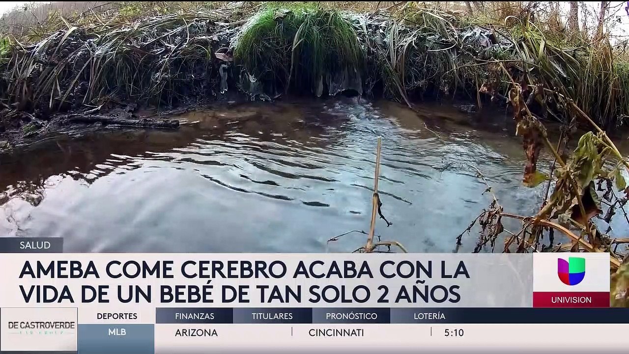 Fallece niño por ameba come cerebros