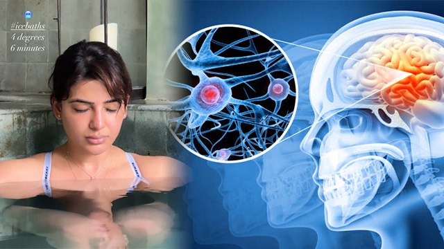 Samantha Ruth Prabhu Bali Vacation 4°C में Ice Bath लेते Video Viral, Benefits Of Ice Bath | Boldsky